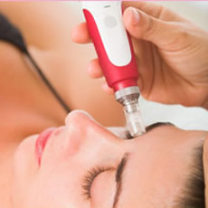 Micro-Needling