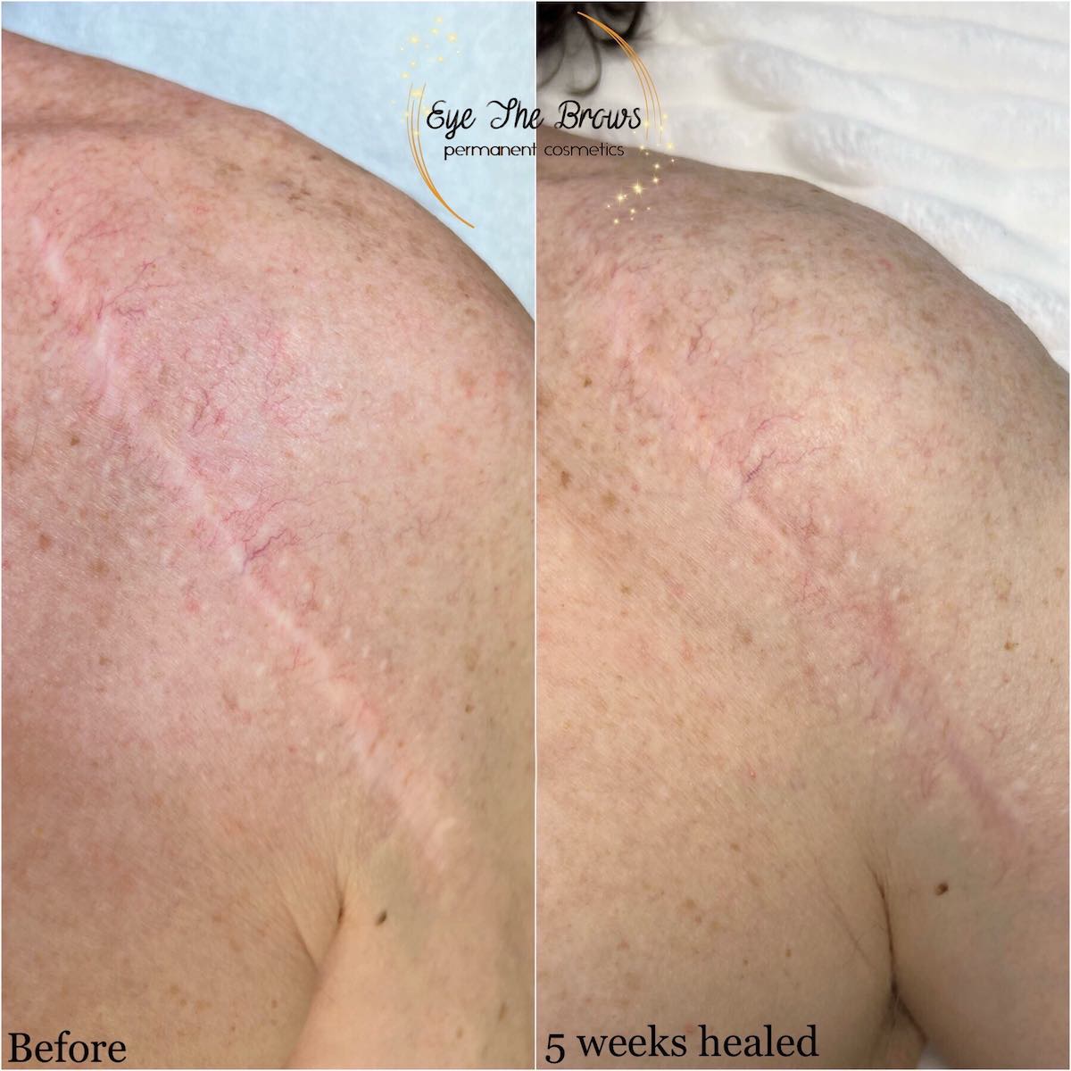 Permanent Makeup,Toronto Permanent Makeup,Permanent Makeup Toronto,Microblading,Lip Blush,Lip Blush Toronto,Eyebrow Microblading Toronto,Ombre Brows Toronto,Permanent Lip Services Toronto,Microblading Near Me Toronto,Lip blush near me Toronto
